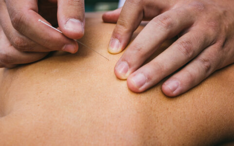 Pijnverlichting door dry needling