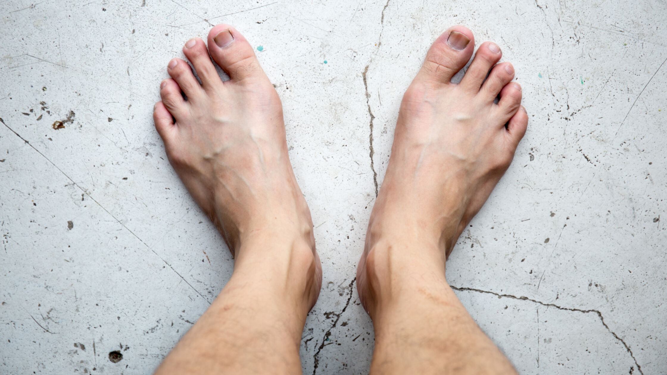 Tip: zorg goed voor je teennagels